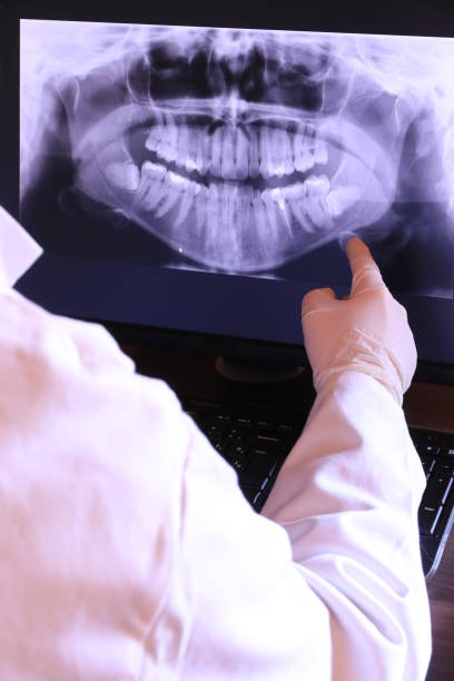 Best Orthodontic Emergency Dentist in Cupertino, CA
